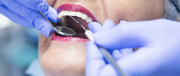 Best Emergency Dentist for Knocked-Out Tooth in Lake Lorelei, OH